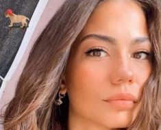 Demet di Daydreamer rifatta le accuse all'attrice turca labbra gonfie