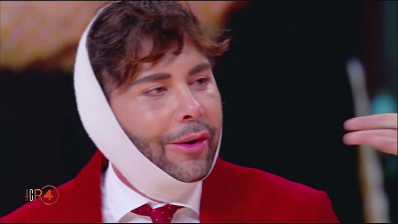Giacomo Urtis rifatto chi è il chirurgo plastico e Grande Fratello Vip