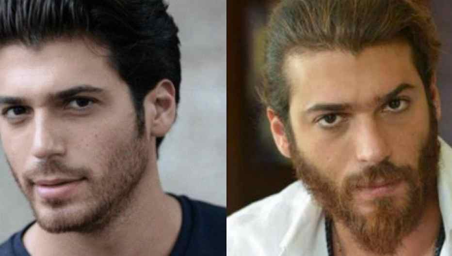 Can Yaman problemi di salute deve fare un interventi chirurgico