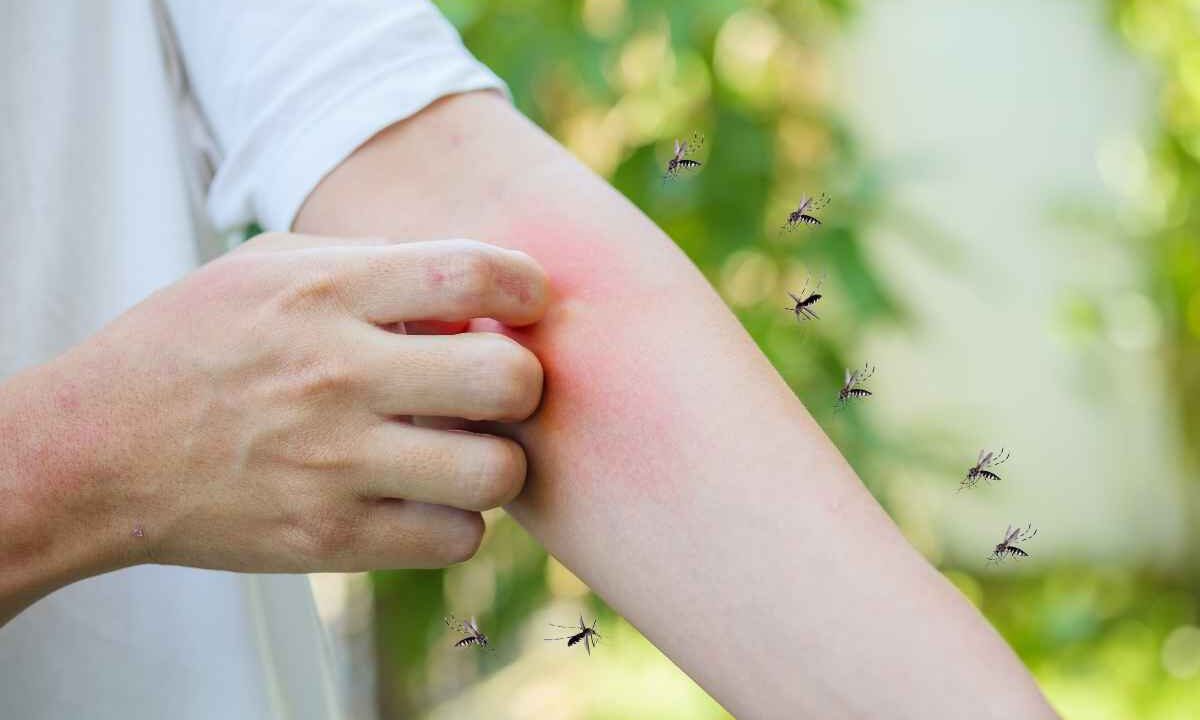 Allarme zanzare, quali funzionano veramente: così non sbagli
